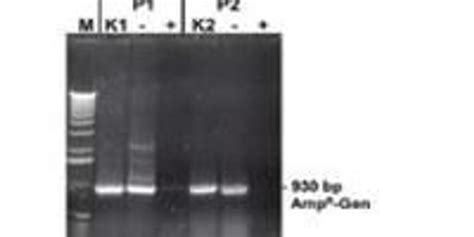 How to Solve Nucleic Acid Contamination 